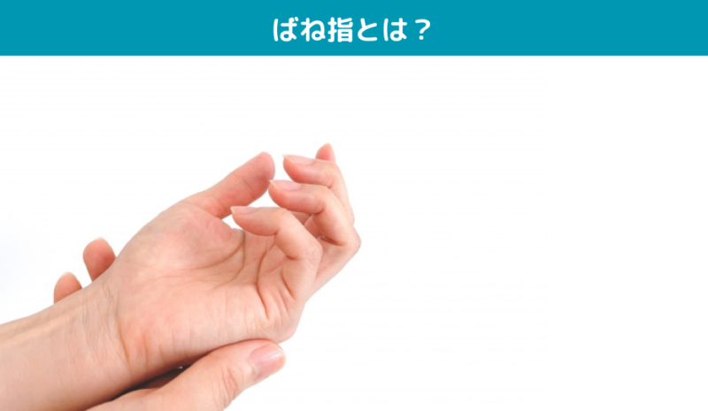 ばね指とは？